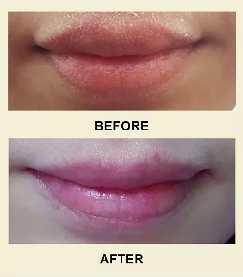 Lip scrub effect